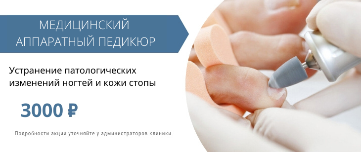 Уход за стопами, медицинский аппаратный педикюр